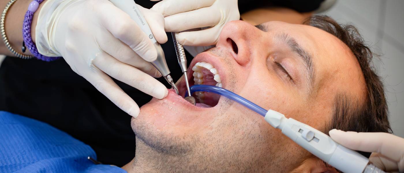 Todo sobre la profilaxis dental